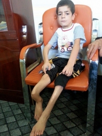 نداء : مهجر من الموصل يناشد المحسنين مساعدتة ليستطيع اكمال علاج ابنه الصغير والمصاب بتشوه عظام الساقين 