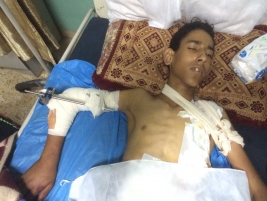 مركز مدينة الصدر: الطفل / احمد فاضل ارحيمة من المصابين في الانفجار الارهابي
