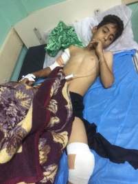 مركز مدينة الصدر : الطفل / علي فاضل ارحيمه اصيب في انفجار ارهابي
