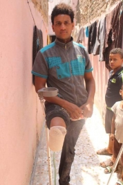 بغداد-فرع مدينة الصدر شاب يبلغ من العمر 28 سنه يحتا ج  الى توفير طرف صناعي وعلاج 