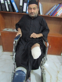 فرع البصرة : الرجل المسن/محمد عبدالخالق يعيل أسرته تعرض الى بتر في ساقه اليسرى