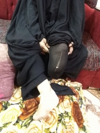 فرع البصرة : السيدة/علية عودة بترت ساقها بسبب مرض مزمن تستغيث بمن يعينها بكرمه الانساني
