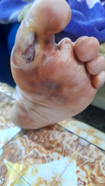 فرع البياع : مازالت الارملة (فضيله م) تناشد اهل البر والاحسان لمد يد العون لهم 